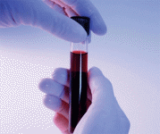 Сколько делается анализ крови на синдром дауна